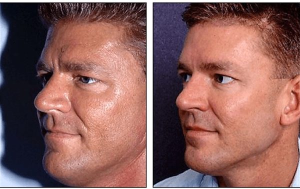 Surgeries To Enhance Your Natural Beauty