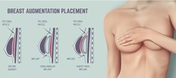 Surgical Procedures That Will Shape Your Body