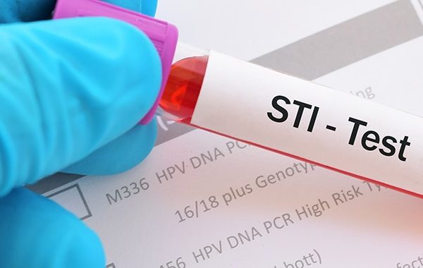 Treatment options for STIs