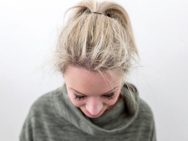 How Does Rogaine Work in Women?