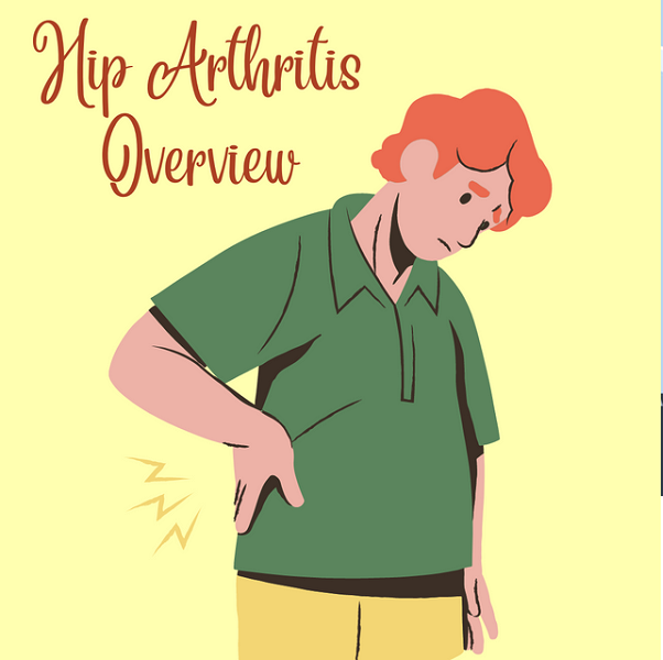    All You Need To Know About Hip Arthritis And Its Treatment
