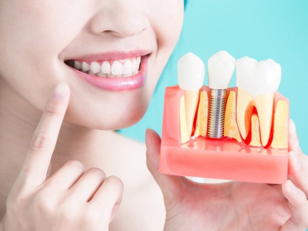 Rebuild Your Smile with Dental Implants Surgery: Benefits and Risks