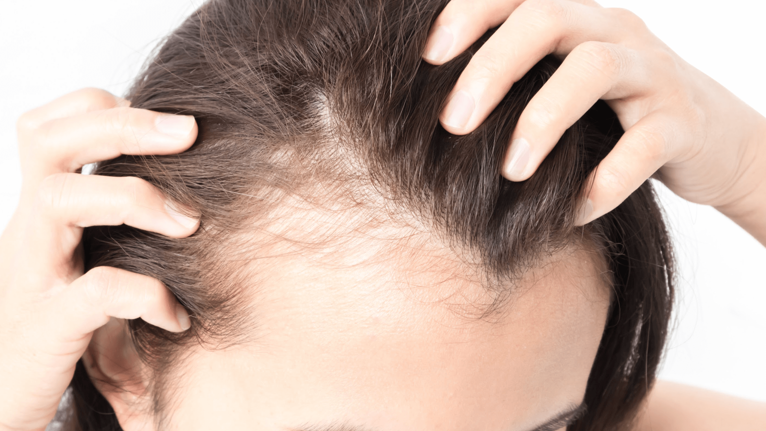 Hair Loss Treatment: Reversing Time and Restoring Confidence