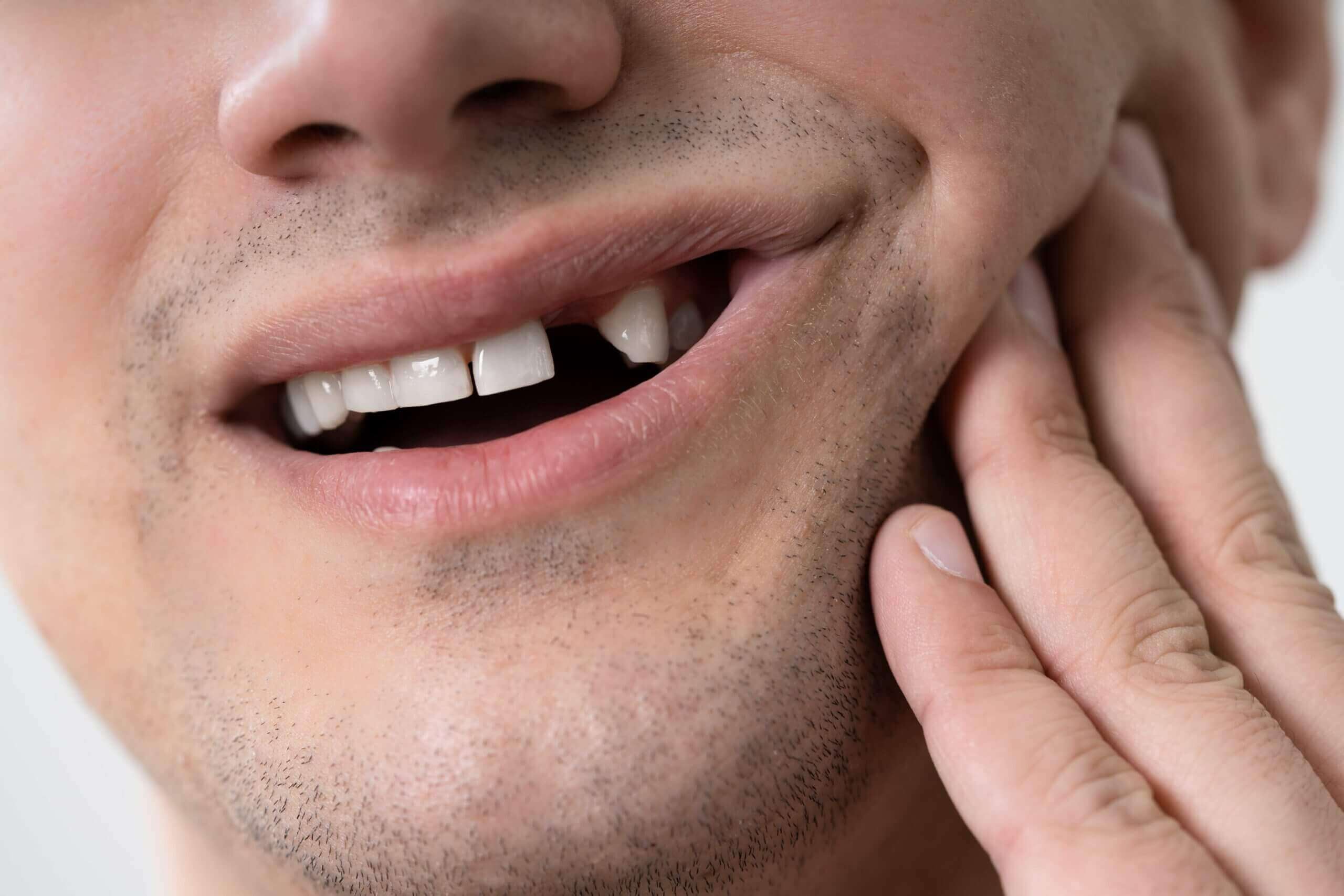 Can Dental Implants Be Used to Fix Broken Teeth? 