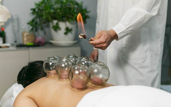 How TCM Clinics Combine Cupping and Acupuncture for Faster Recovery