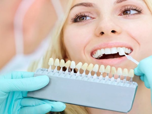 Important Things To Know About Dental Probiotics